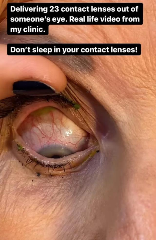 Gözündeki aşırı kaşıntı için hastaneye giden kadın, doktorun dudağından dökülen sözlerle hayatının şokunu yaşadı