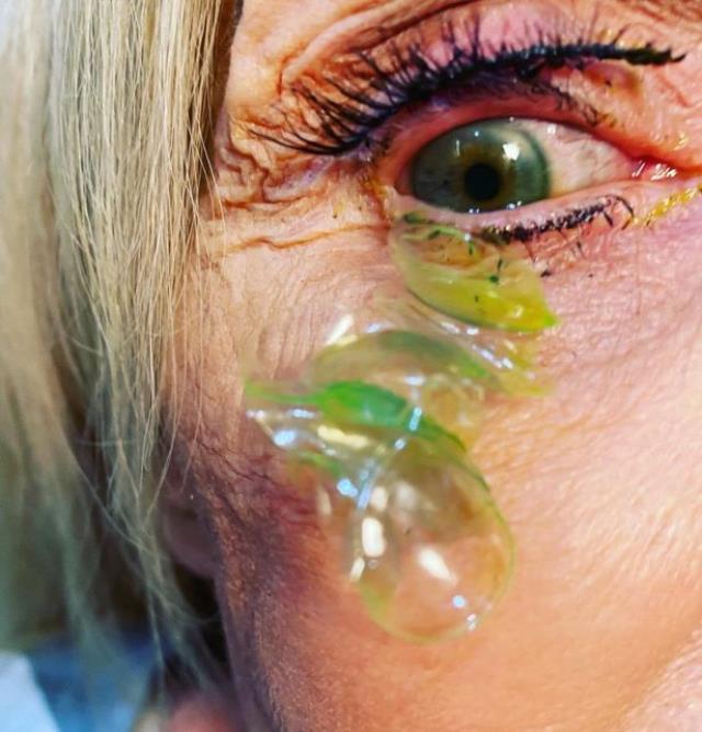 Gözündeki aşırı kaşıntı için hastaneye giden kadın, doktorun dudağından dökülen sözlerle hayatının şokunu yaşadı