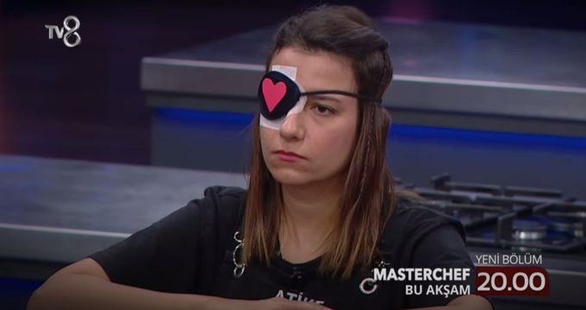 MasterChef Atike'nin gözünde neden bant var? Atike'nin gözüne ne oldu? MasterChef Atike ne oldu?