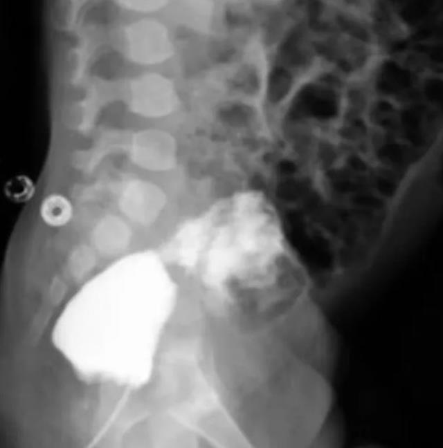 Ultrasonda hamile kadının karnındaki bebeğin cinsel bölgesine bakan doktorların ağzı açık kaldı