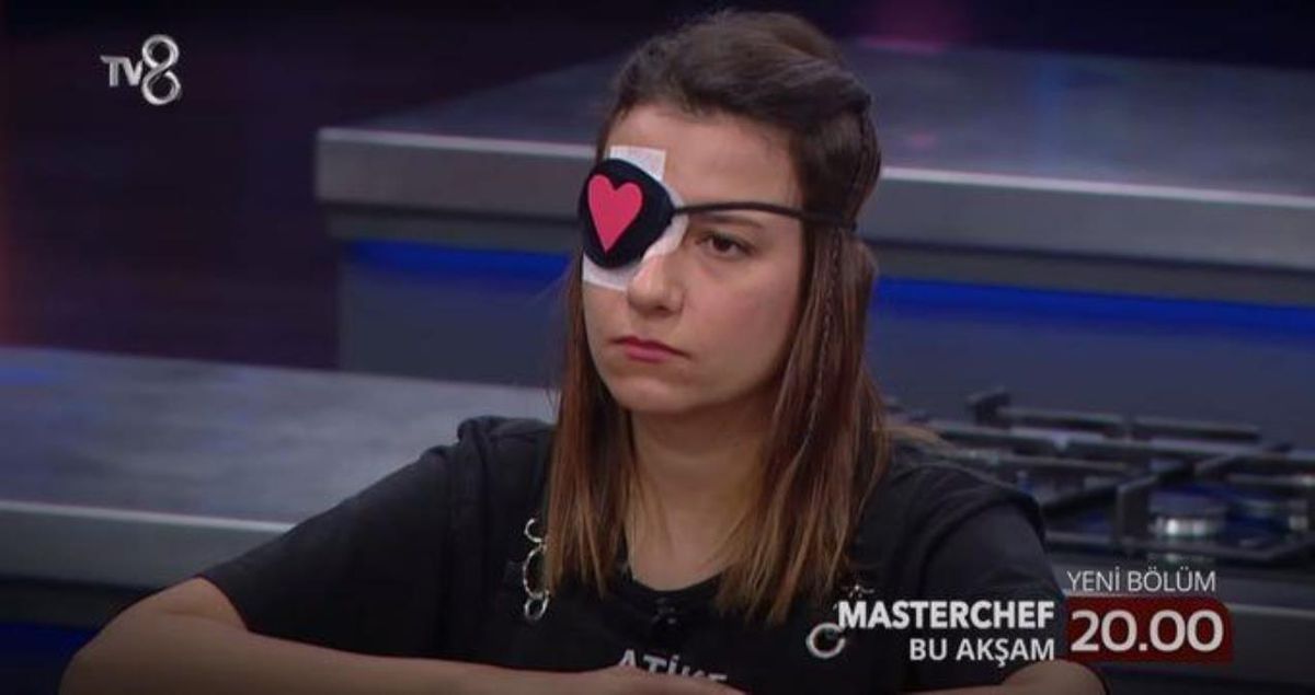 MasterChef Atike'nin gözüne ne oldu? MasterChef Atike'nin gözünde neden bant var? MasterChef Atike hasta mı?