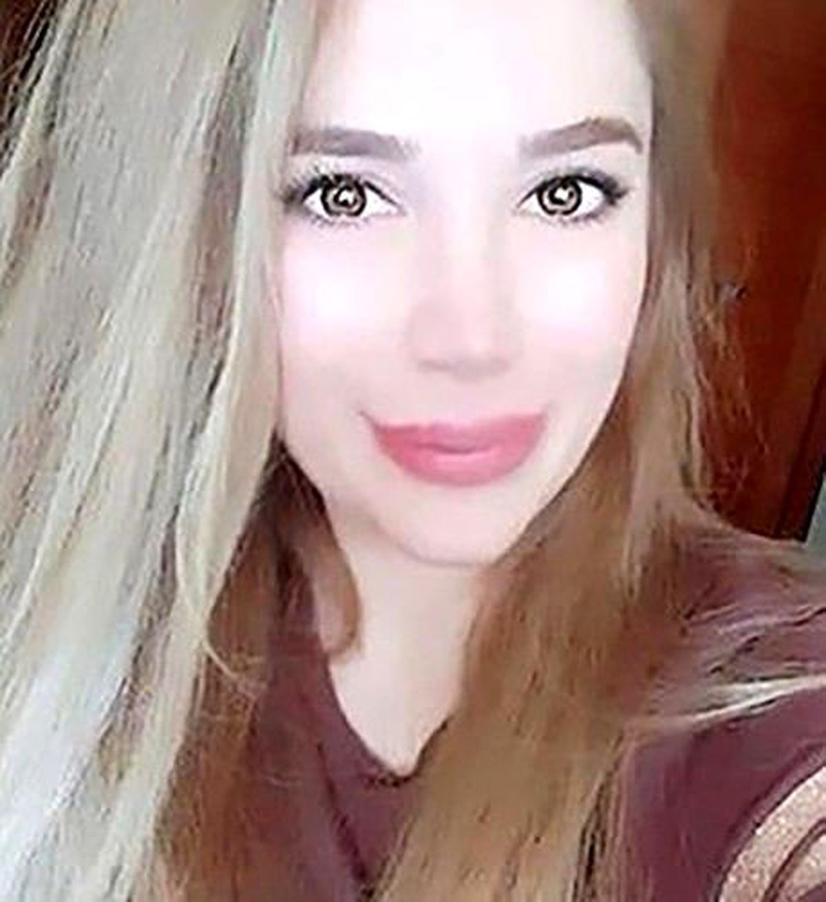 Botoks sonrası ölüm davasında yargılanan sanık hayatını kaybetti