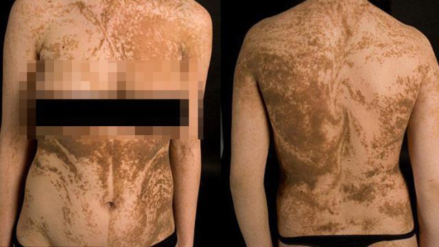 İnsan vücudunda bulunan gizli çizgilerin sırrı ortaya çıktı! Sadece kediler görebiliyor İnsan vücudunda bulunan gizli çizgilerin sırrı ortaya çıktı! Sadece kediler görebiliyor