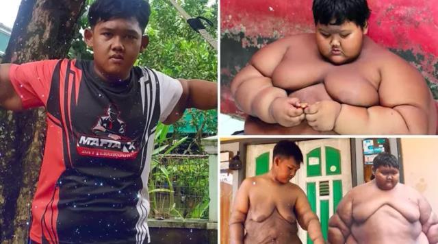 Dünyanın en şişman çocuğuydu, azmedip zayıfladı! Son halini görenler tanıyamıyor