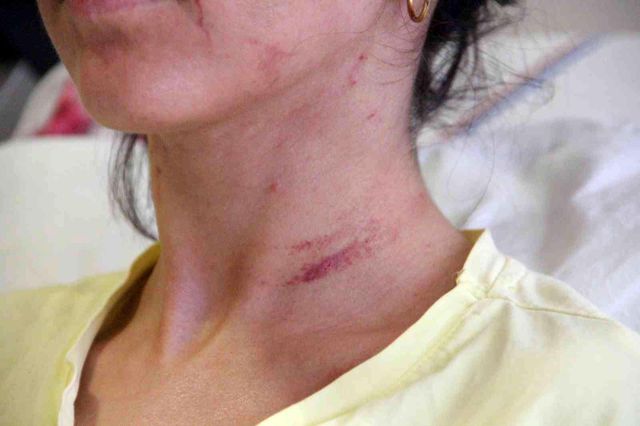 Kıskançlık tartışmasında sevgilisini 5 yerinden bıçaklayan doktorun 20 yıl hapsi istendi Kıskançlık tartışmasında sevgilisini 5 yerinden bıçaklayan doktorun 20 yıl hapsi istendi