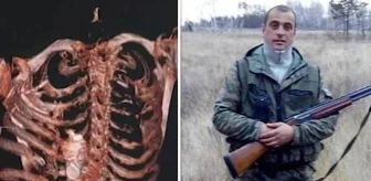 Patlamamış el bombası Rus askerin göğüs kafesine sıkıştı