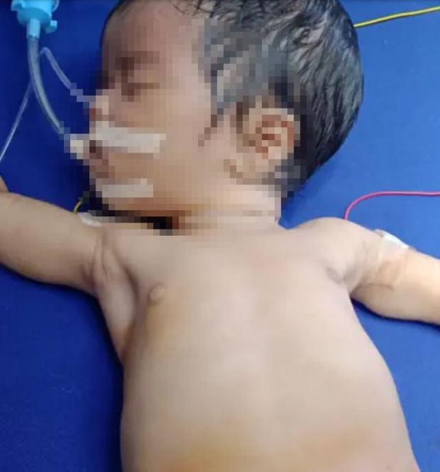 Yeni doğan bebeğin karnını açan doktorlar, karşılarına çıkan manzaraya inanamadı Yeni doğan bebeğin karnını açan doktorlar, karşılarına çıkan manzaraya inanamadı