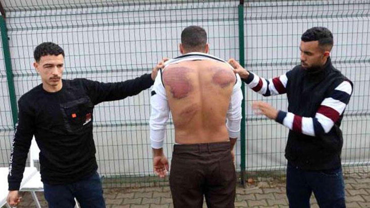 Yunan güvenlik güçleri düzensiz göçmenlere işkence yaptı