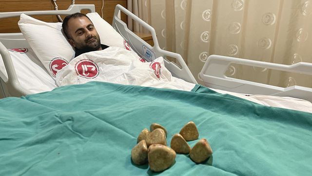 Karın ağrısı şikayetiyle hastaneye giden vatandaş acilen ameliyata alındı: Karşımızda ilginç bir vaka var