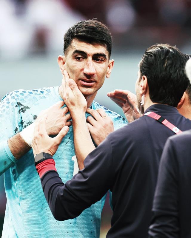 Dünya Kupası'nda yüreklar ağza geldi! Takım arkadaşıyla çarpışan kalecinin son hali içler acısı Dünya Kupası'nda yüreklar ağza geldi! Takım arkadaşıyla çarpışan kalecinin son hali içler acısı