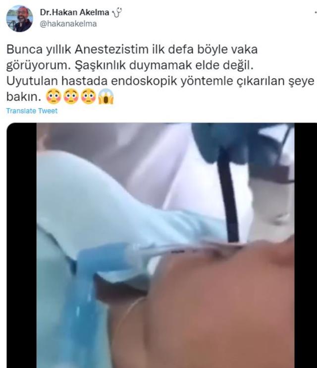 Gencin midesinden çıkarılan yılanı gören tecrübeli doktorun bile nutku tutuldu