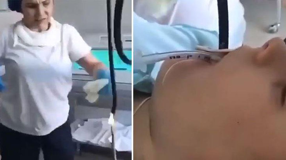 Genç kadının midesinden çıkarılan yılan, meğerse içeri böyle girmiş