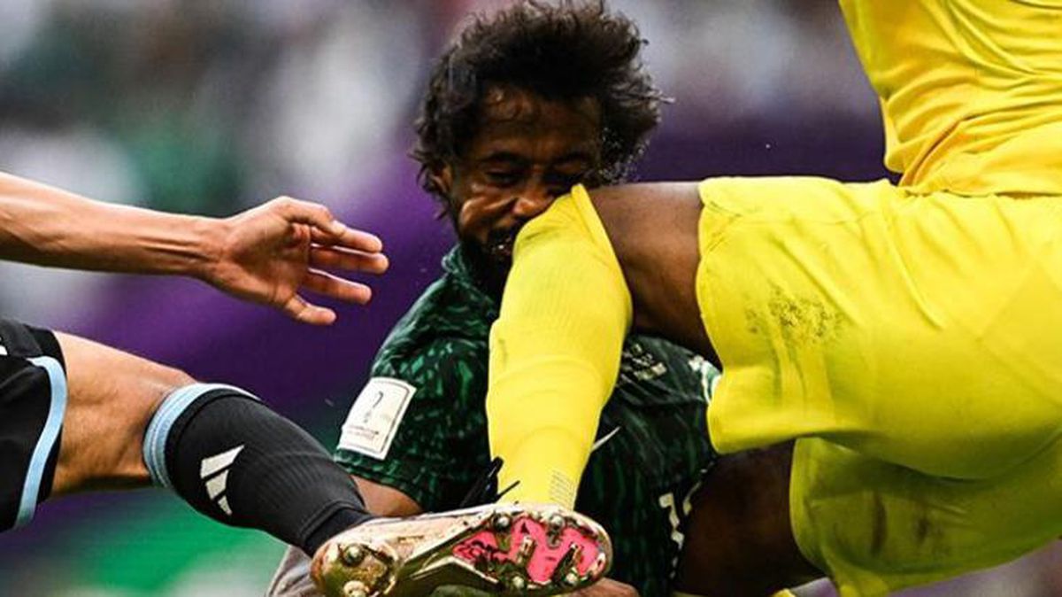 Arjantin maçında yüzü adeta dağılmıştı! Suudi futbolcu hastaneden son halini paylaştı
