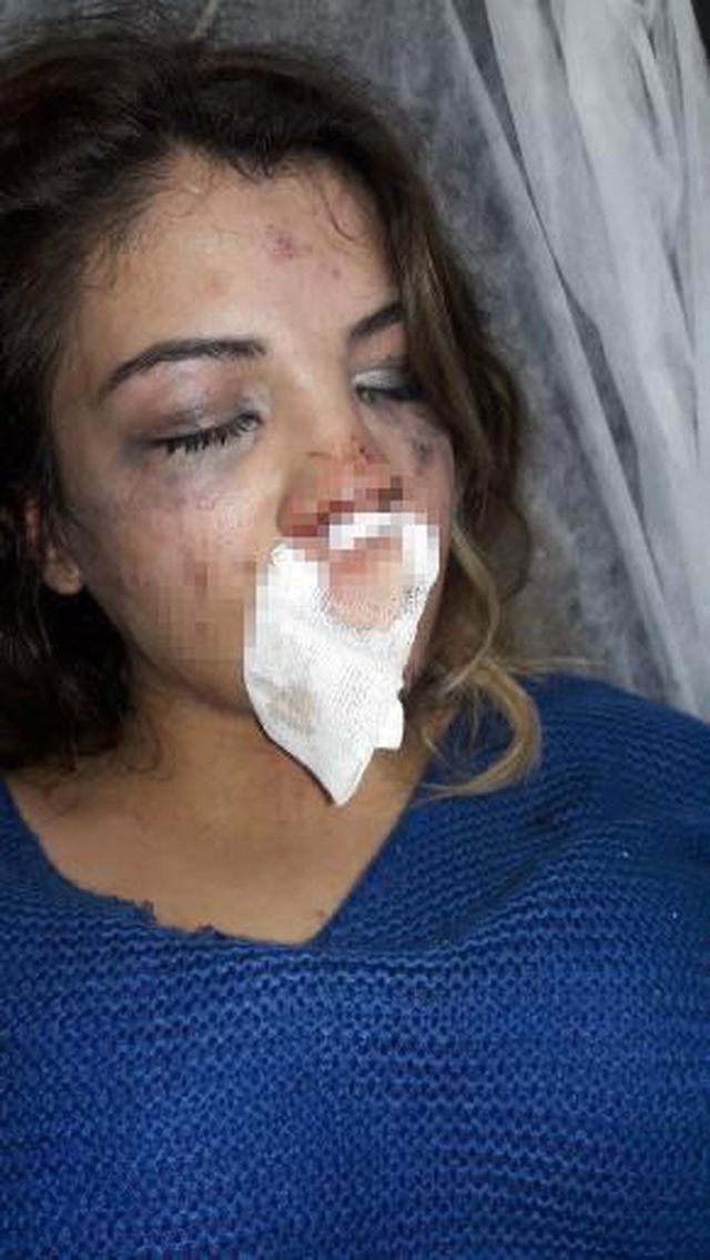 Üsküdar'da koca dehşeti: 4 aylık hamile karısını çocuğunun gözü önünde dövdü