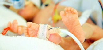 Tıp dünyasını şaşırtan olay! Meksika'da bir bebek 5.7 santim kuyrukla dünyaya geldi