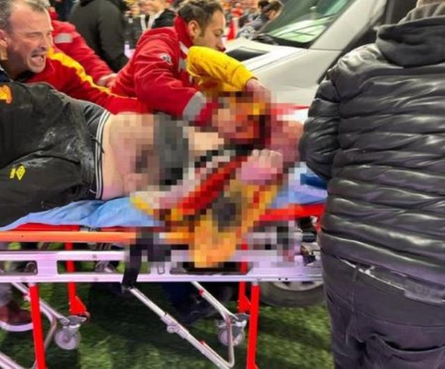 İzmir derbisinde suratına havai fişek isabet eden taraftarla ilgili kahreden ihtimal: Bir daha konuşamayabilir