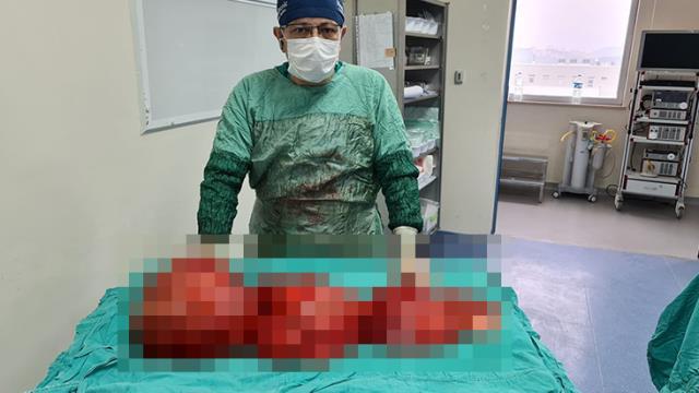 Tokat'ta kilo aldığını sanan damın karnından 13 kilo kitle çıkartıldı