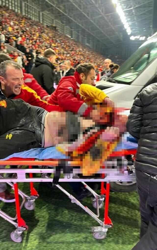 İşaret fişeğiyle Göztepeli taraftarın canına kasteden şüphelinin ilk ifadesi ortaya çıktı: Rastgele attım İşaret fişeğiyle Göztepeli taraftarın canına kasteden şüphelinin ilk ifadesi ortaya çıktı: Rastgele attım