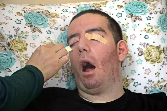 10 yıldan bu yana göz kapaklarını tek bir kele bile kırpmadı: Artık gözlerinden kan geliyor