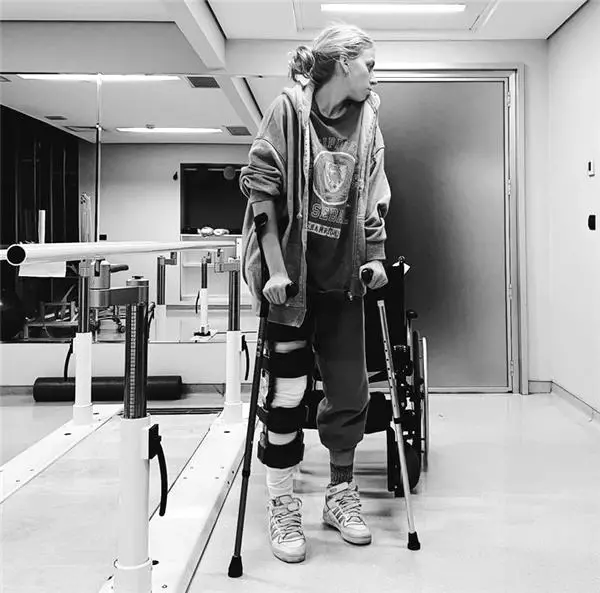 Oyuncu Melis İşiten, ölümden döndüğü kaza tarihini dövme yaptırdı