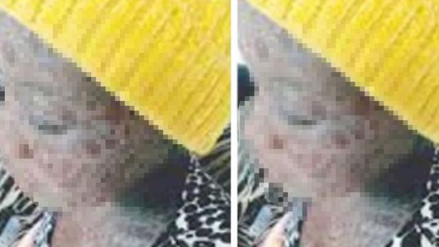Yılan bebekten sonra bu sefer de yılan kız! Görüntüsü herkesi hayrete düşürdü