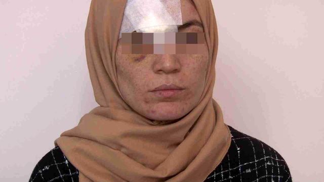 Cinsel ilişki teklifini reddeden karısını hastanelik etti: Senin başka görevin mi var? Cinsel ilişki teklifini reddeden karısını hastanelik etti: Senin başka görevin mi var?