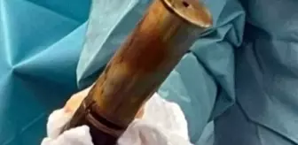 Bir garip olay! Anüsüne top mermisi sıkışan 88 yaşındaki adam hastanede herkesi şaşkına çevirdi