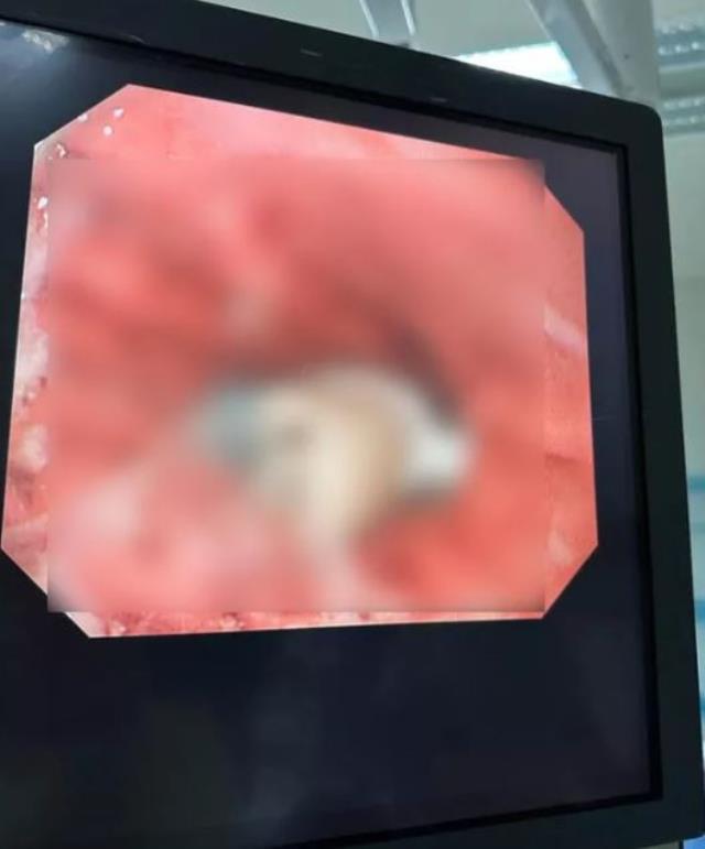 Korkunç ağrılarla hastaneye giden çocuğun röntgenine bakan doktorlar, anne babasına kızdı Korkunç ağrılarla hastaneye giden çocuğun röntgenine bakan doktorlar, anne babasına kızdı