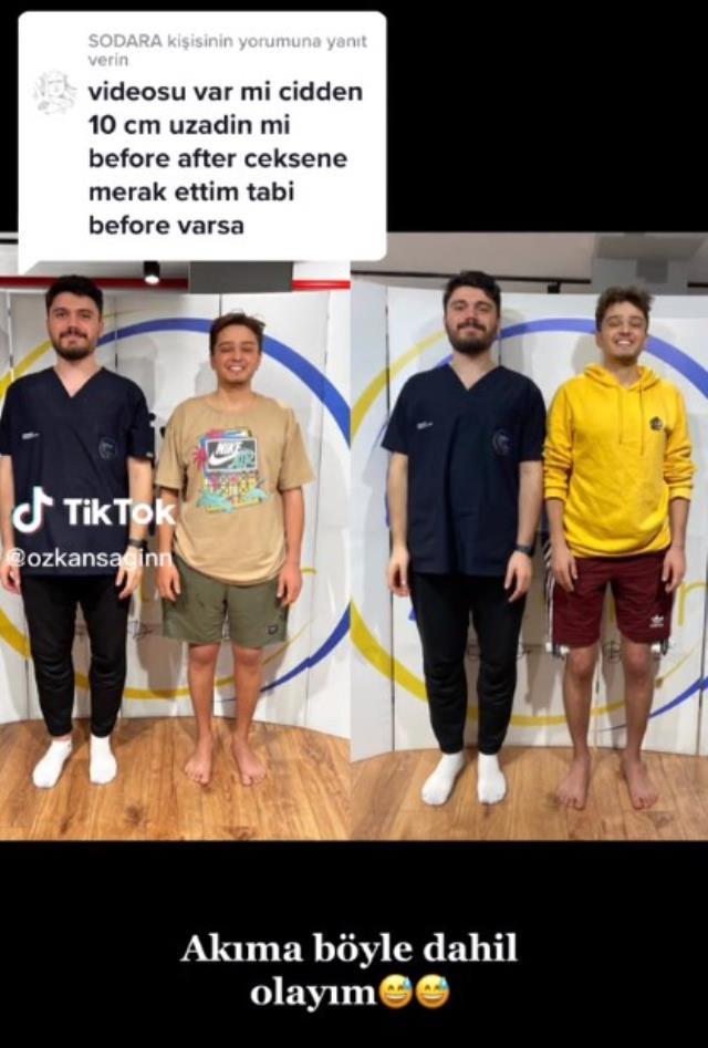 TikTok fenomeni Özkan Sağın, boy uzatma ameliyatı oldu