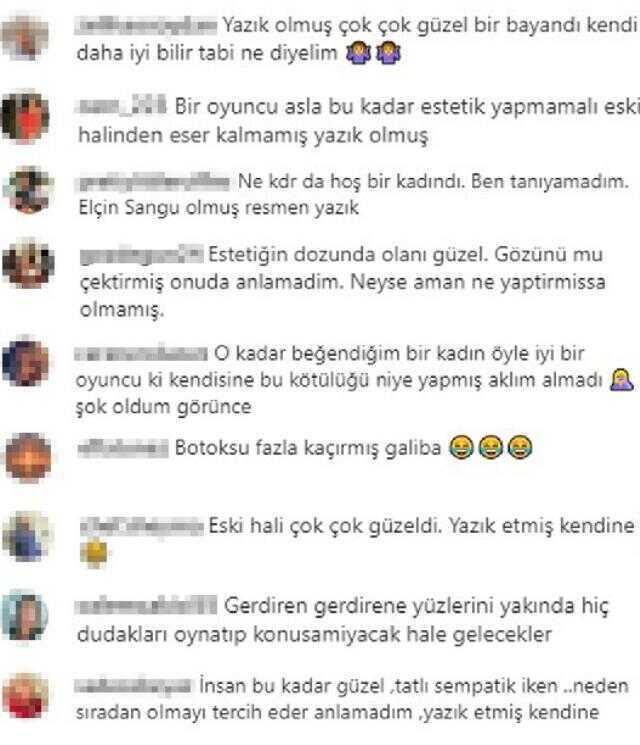 Mine Tugay estetik mi yaptırdı? Yüzünü son halini gören kullanıcılar aynı yorumu yapıyor: Güzelliğine yazık olmuş