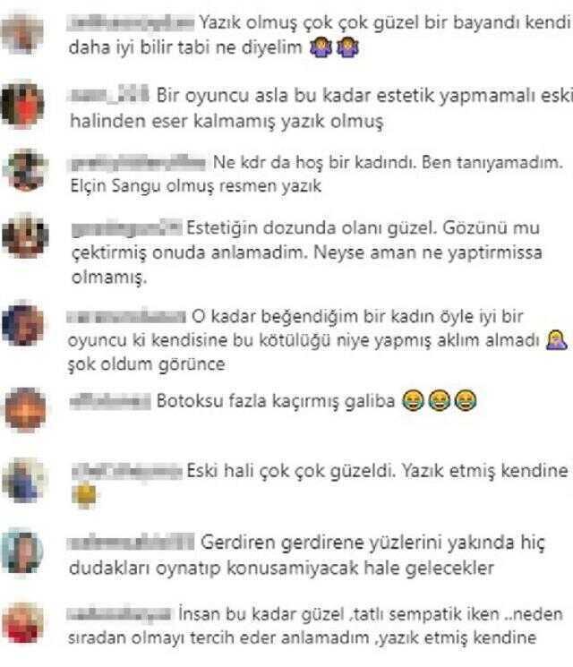 Mine Tugay'ın yüzüne ne oldu, estetik mi yaptırdı? Mine Tugay estetikli mi, esteksiz mi?