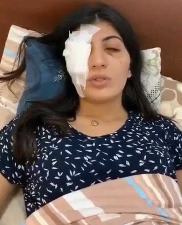 Su dolu balonla Hatice'yi gözünden yaralayan sanıklar: Şaka yaptık Su dolu balonla Hatice'yi gözünden yaralayan sanıklar: Şaka yaptık