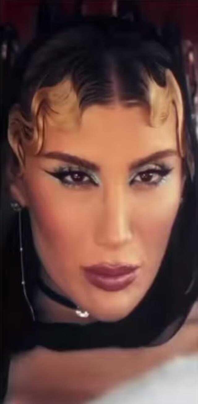 'Dudağımı da yaptırdım, yaptırmadığım yerim kalmadı' diyen İrem Derici'nin son hali 'Dudağımı da yaptırdım, yaptırmadığım yerim kalmadı' diyen İrem Derici'nin son hali