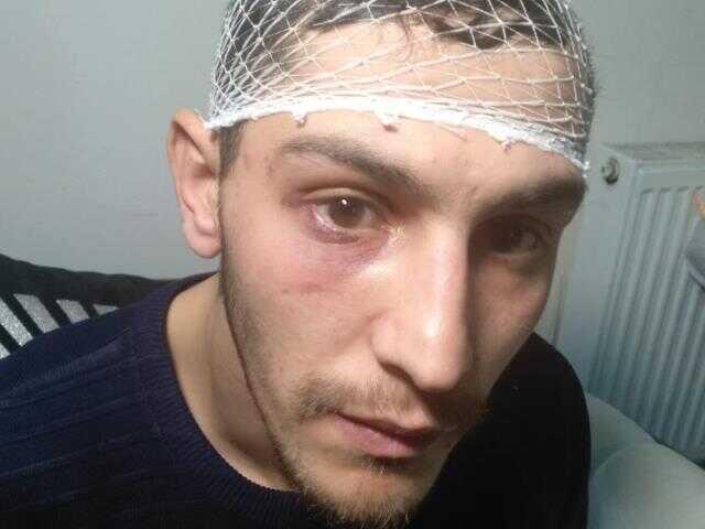 İş aramaya giden genç, 4 kişinin saldırısına uğradı! Önce darp sonra da gasp edildi