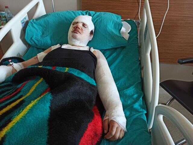 Depremzede eski eşini kaynar suyla yakan adamdan akıllara ziyan savunma: Artçı sarsıntı nedeniyle oldu