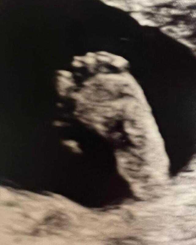 Oyuncu Bora Akkaş ve Oben Alkan çiftinden bebek müjdesi Oyuncu Bora Akkaş ve Oben Alkan çiftinden bebek müjdesi