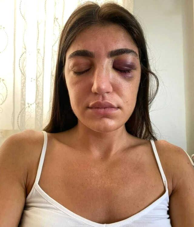 Manken Gizem Akbaş'ın darp edilmesine ilişkin davada sanığa 1 yıl hapis talebi