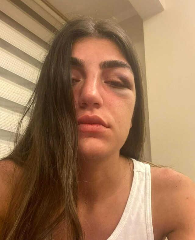 Manken Gizem Akbaş'ın darp edilmesine ilişkin davada sanığa 1 yıl hapis talebi