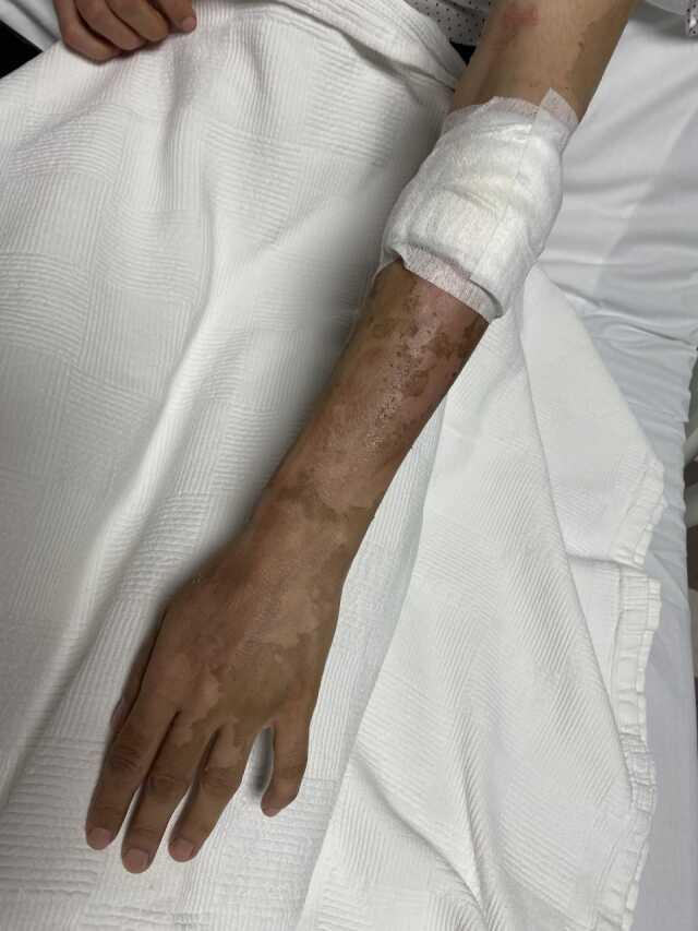 Lavabo açıcı bomba gibi patladı! Kıyafetleri pul pul dökülen genç kadın acılar içinde hastaneye koştu Lavabo açıcı bomba gibi patladı! Kıyafetleri pul pul dökülen genç kadın acılar içinde hastaneye koştu