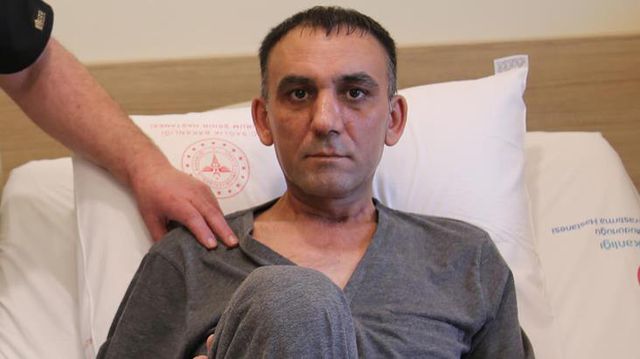 Karnında büyüyen şişlikten illallah edip acile gitti, ince bağırsağından 3,5 kilo ur çıktı Karnında büyüyen şişlikten illallah edip acile gitti, ince bağırsağından 3,5 kilo ur çıktı
