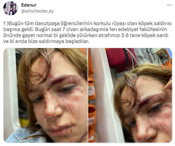 Yıldız Teknik Üniversitesi'nde rezalet! Başıboş köpekler öğrenciye saldırdı Yıldız Teknik Üniversitesi'nde rezalet! Başıboş köpekler öğrenciye saldırdı