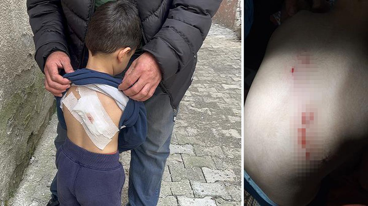 Sokakta oyun oynayan çocuğa başıboş köpekler saldırdı