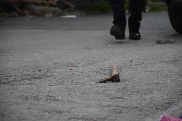 Polise baltayla saldıran şüpheli, bacağından vuruldu