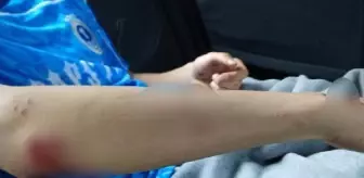 Köpeklerin saldırdığı lise öğrencisi yaralandı