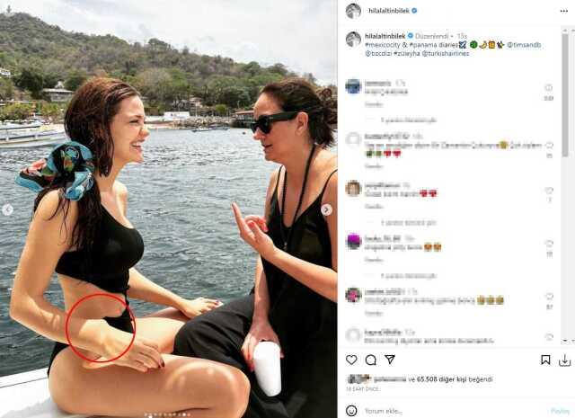 Mayolu fotoğrafına phostoshop yapmak isteyen Hilal Altınbilek, dozu kaçırınca kolunu yamulttu Mayolu fotoğrafına phostoshop yapmak isteyen Hilal Altınbilek, dozu kaçırınca kolunu yamulttu