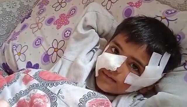 6 yaşındaki çocuğa sokak köpekleri saldırdı: 40 dikiş atıldı 6 yaşındaki çocuğa sokak köpekleri saldırdı: 40 dikiş atıldı