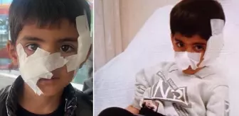 Başıboş sokak köpeklerinin saldırdığı 6 yaşındaki çocuğa 40 dikiş atıldı