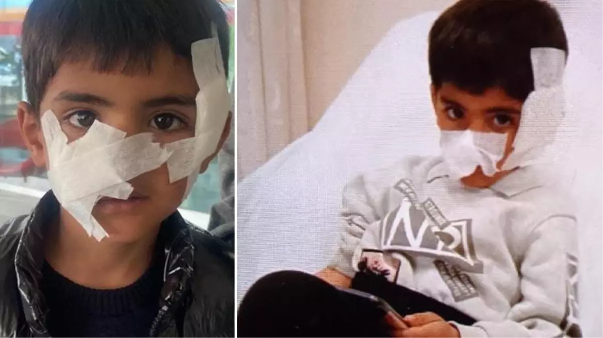 Başıboş sokak köpeklerinin saldırdığı 6 yaşındaki çocuğa 40 dikiş atıldı