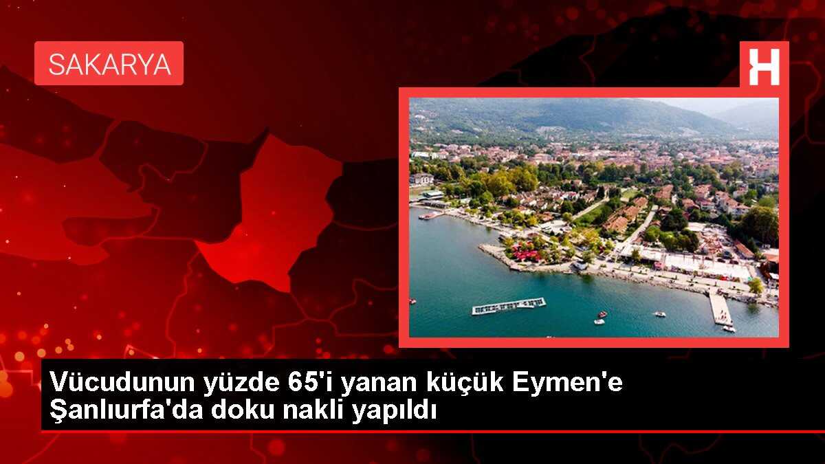 Vücudunun yüzde 65'i yanan küçük Eymen'e Şanlıurfa'da doku nakli yapıldı