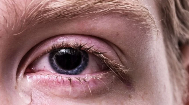 ABD'de göz damlalarına bağlı enfeksiyon salgını! Görme kaybı ve ölümler artıyor